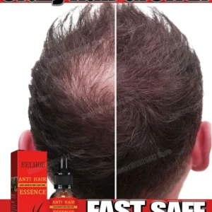 tratamiento esencial para el crecimiento del cabello, fortalece el cabello, nutre el cuero cabelludo, peso ligero, no graso, mejora la circulación del cuero cabelludo